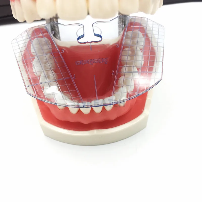 1db Dental Lab Fogászati vezetőlemez Fogak elrendezése műfogsorszerszámokon Fogászati ellátó fog - 1