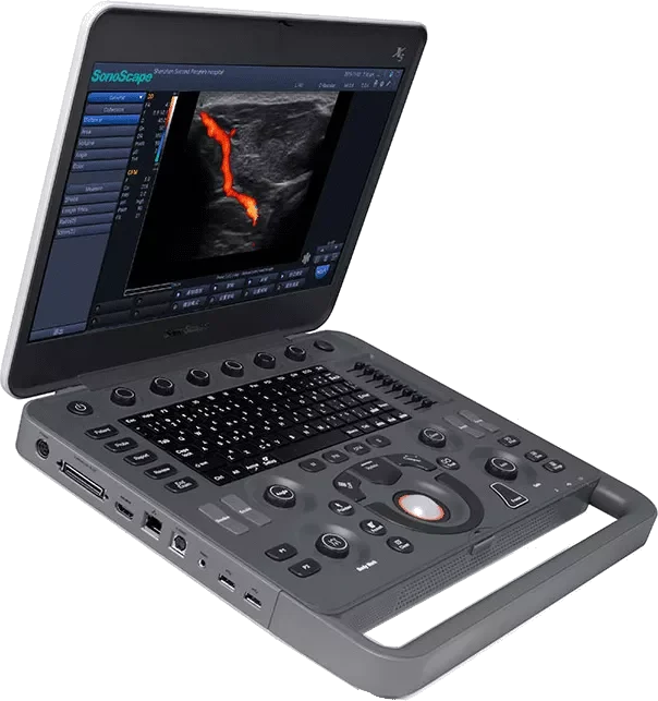 SonoScape hordozható diagnosztikai színes Doppler ultrahang rendszer X5Vet - 1