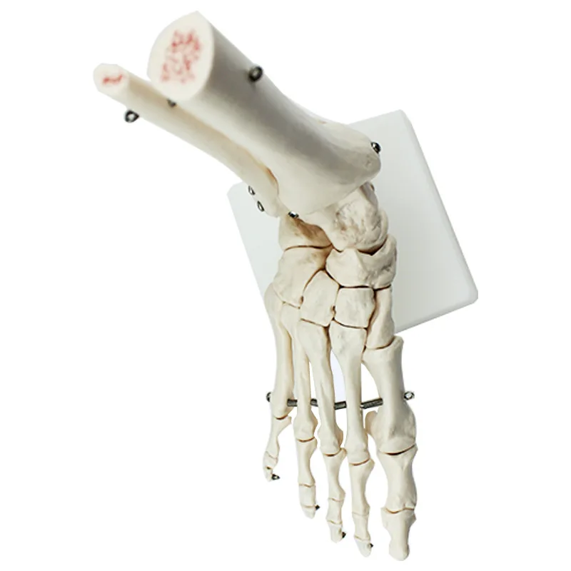 Vadonatúj 1: 1 láb ízületi modell lábcsont modell orvosi kutatás láb anatómia klinikai kijelző oktatási modell - 1