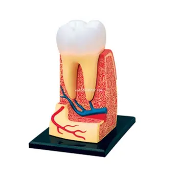 Kivehető fogak anatómiai modellje Fogprotézis bemutató eszköz fogorvosi cseppfolyóhoz