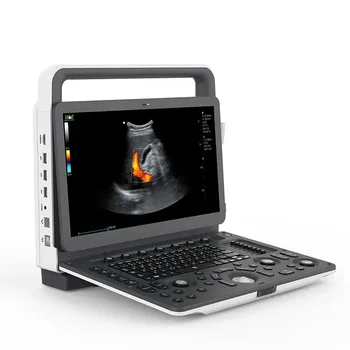  legújabb érkezés Sonoscape E2 M20 ultrahang szkenner / orvosi ultrahang gép konvex szondával