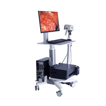 Hordozható hüvely és vulva elektronikus digitális videó kolposzkóp nőgyógyászathoz